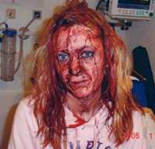  raped and beaten half to death by four Somali immigrants